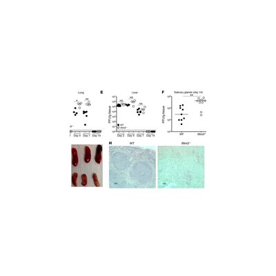 Scientists have found a new gene responsible for an inflammatory reaction