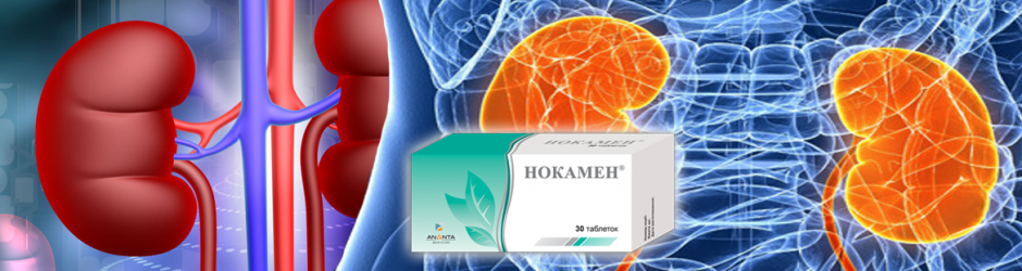 Клінічна ефективність застосування фітопрепарату НОКАМЕН у комплексному лікуванні пацієнтів з уролітіазом